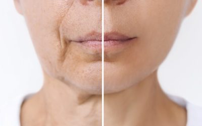 Signes et causes du vieillissement du visage